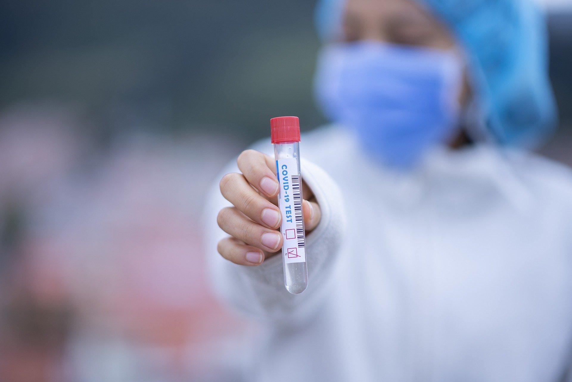 Test antygenowy w kierunku zakażenia koronawirusem SARS-CoV-2 wraz z zaświadczeniem lekarskim w języku polskim lub angielskim